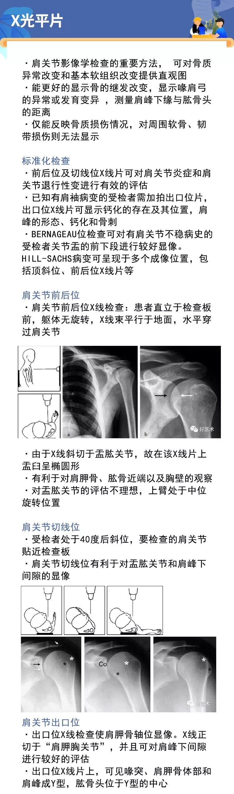 肩关节损伤的影像学诊断技巧，看这篇就够了！