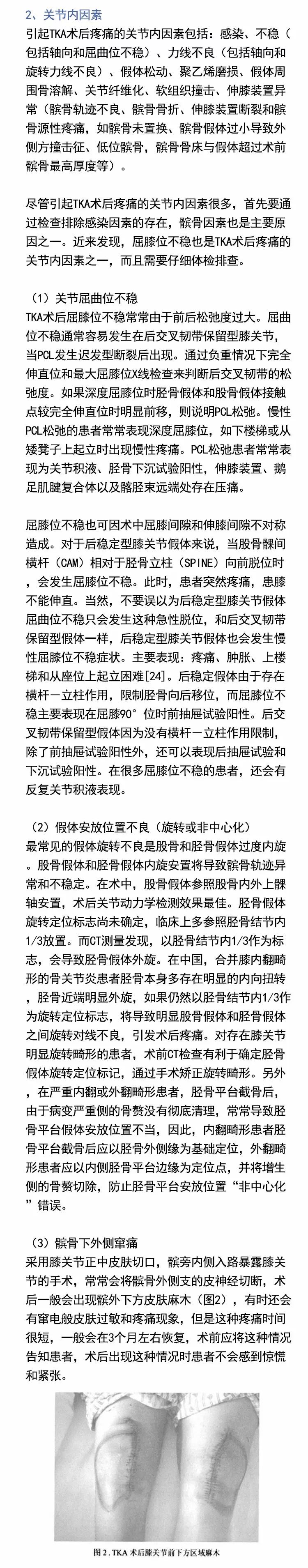 如何防止膝关节置换术后疼痛？三张图解决难题！