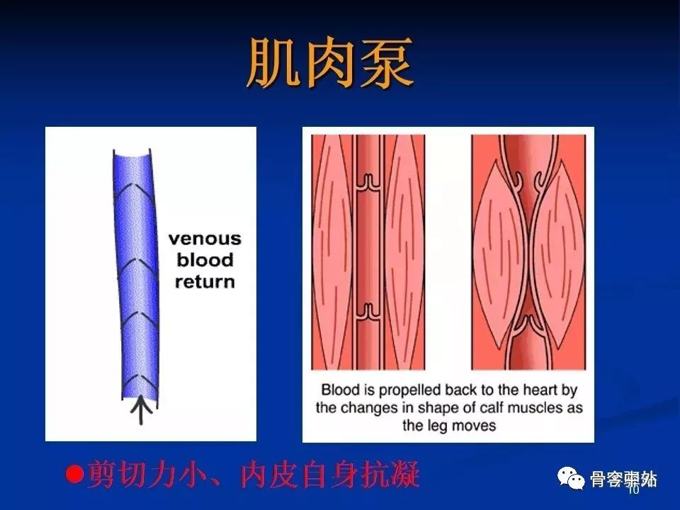 Virchow三角理论，剖析骨科手术后最无声的杀手！