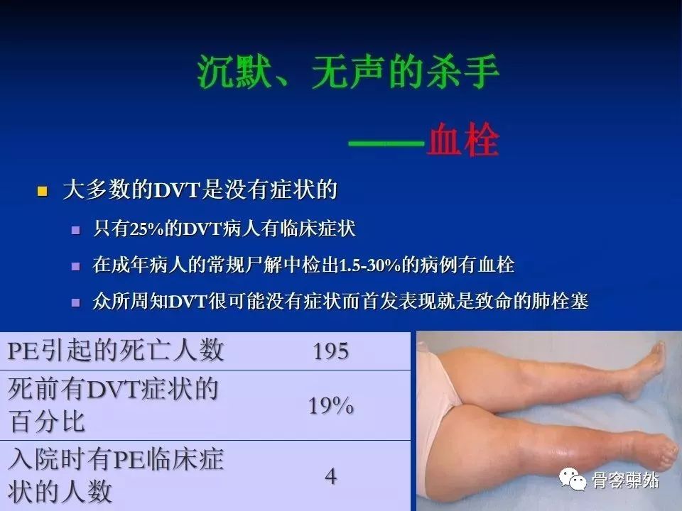 Virchow三角理论，剖析骨科手术后最无声的杀手