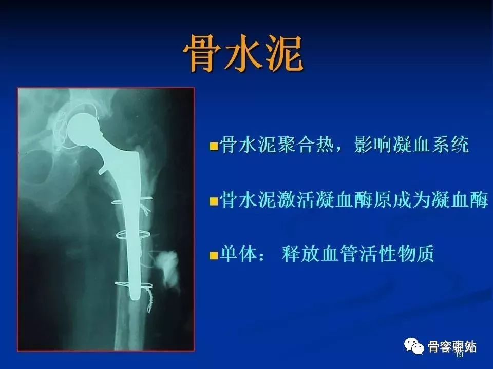 Virchow三角理论，剖析骨科手术后最无声的杀手