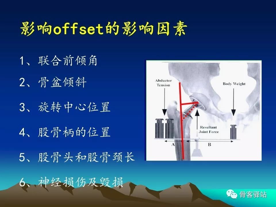 初次全髋关节置换术，技巧要点都在这！