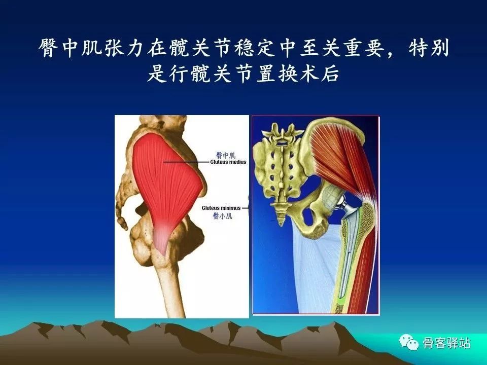 初次全髋关节置换术，技巧要点都在这！