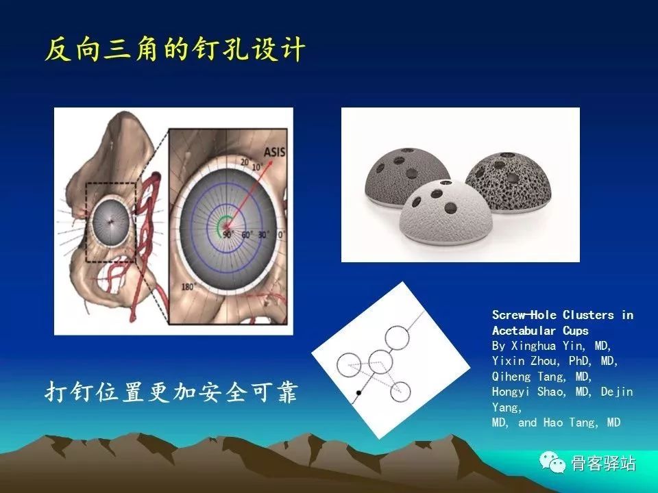 初次全髋关节置换术，技巧要点都在这！