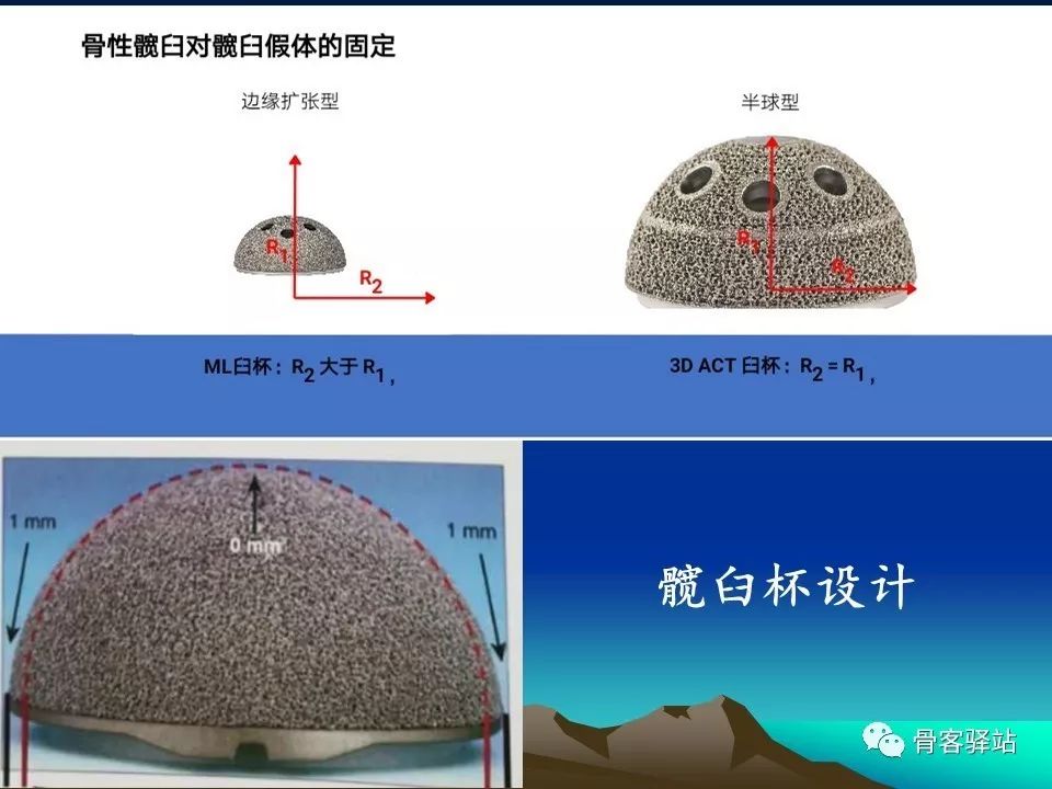 初次全髋关节置换术，技巧要点都在这！