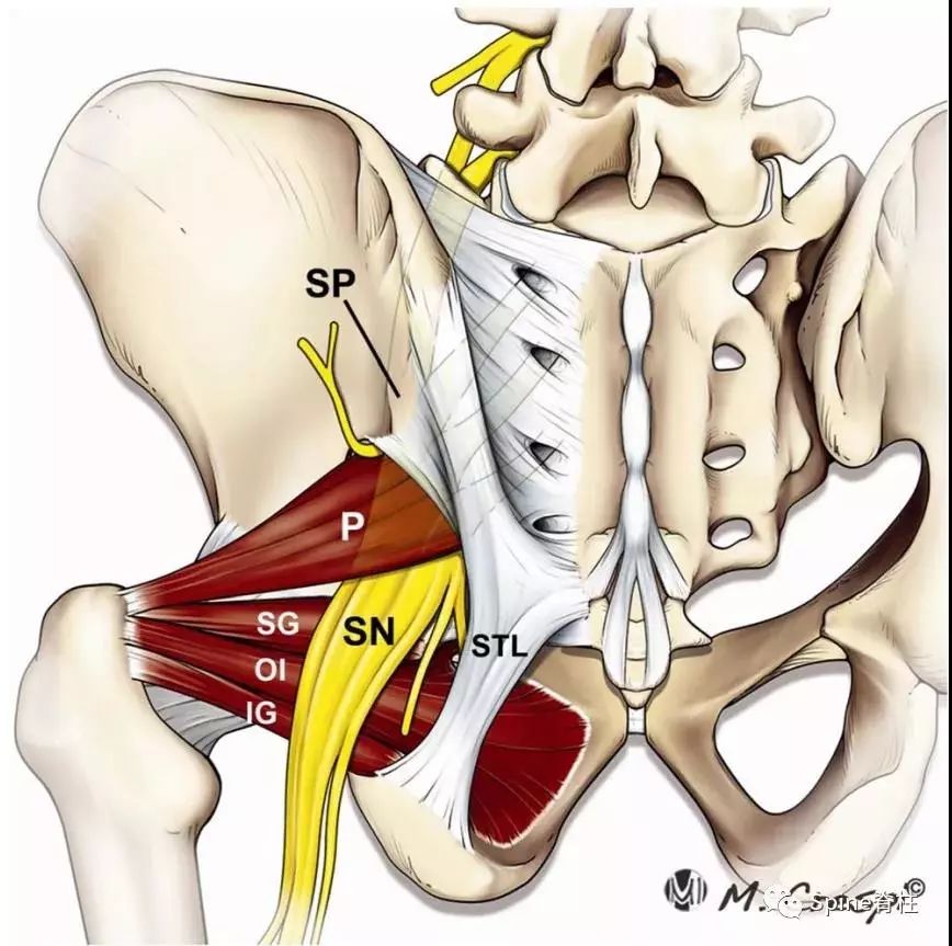 关于梨状肌综合征，你全都了解吗？