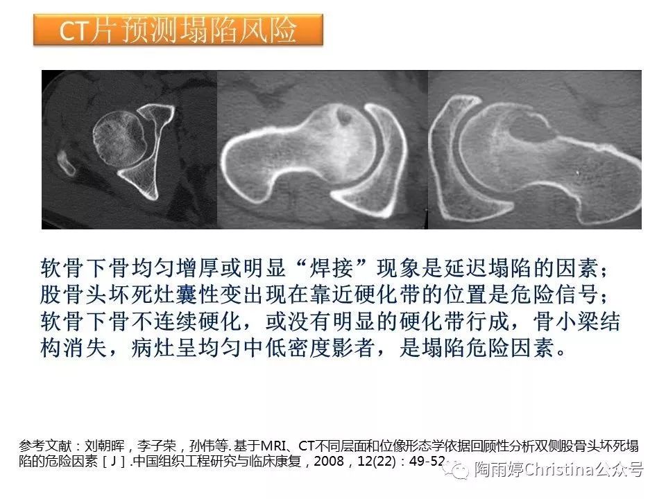 股骨头坏死的诊断与保髋方法的选择