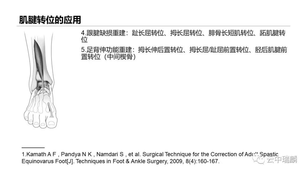 一文掌握：肌腱转位的原则及手术要点