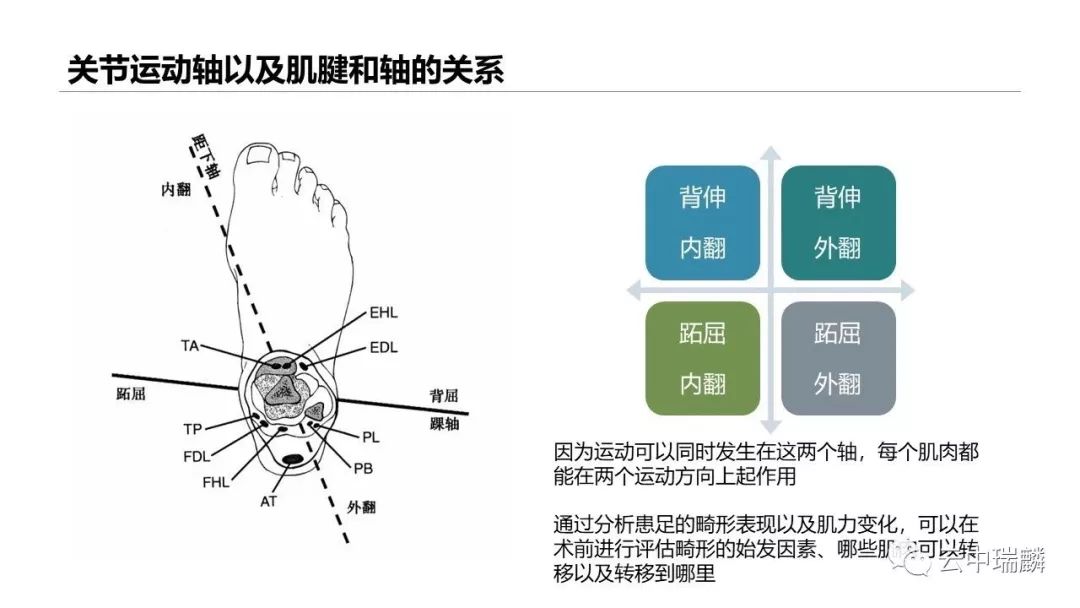 一文掌握：肌腱转位的原则及手术要点