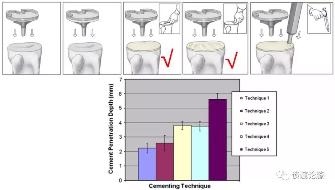 TKA中骨水泥知识，你真的都get了吗？