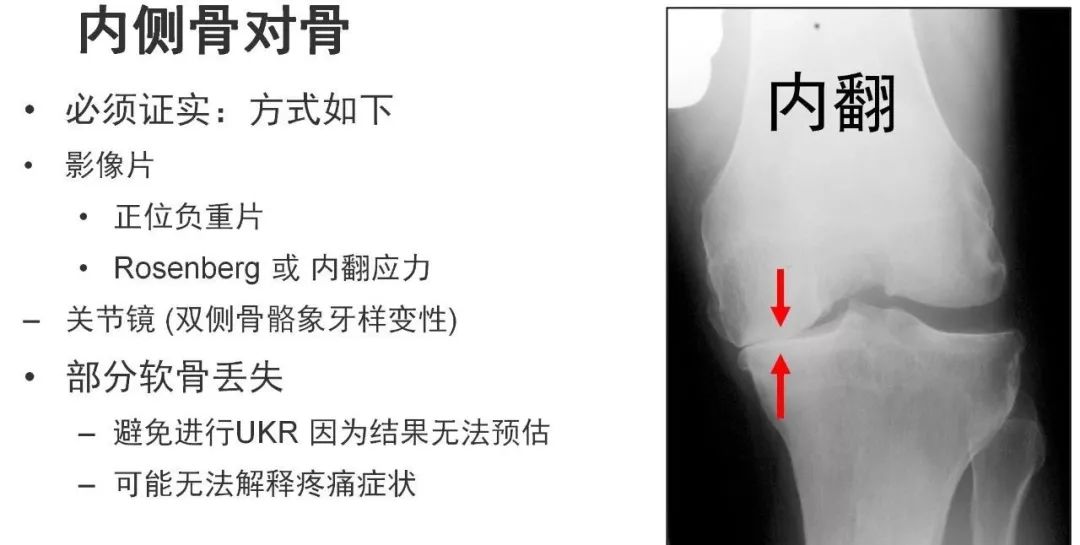 图解：单髁置换手术技巧，赶紧收藏起来！