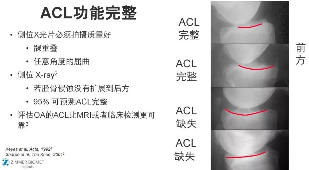 图解：单髁置换手术技巧，赶紧收藏起来！