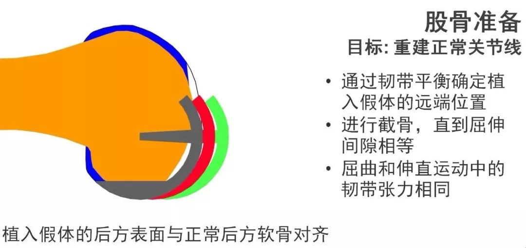 图解：单髁置换手术技巧，赶紧收藏起来！