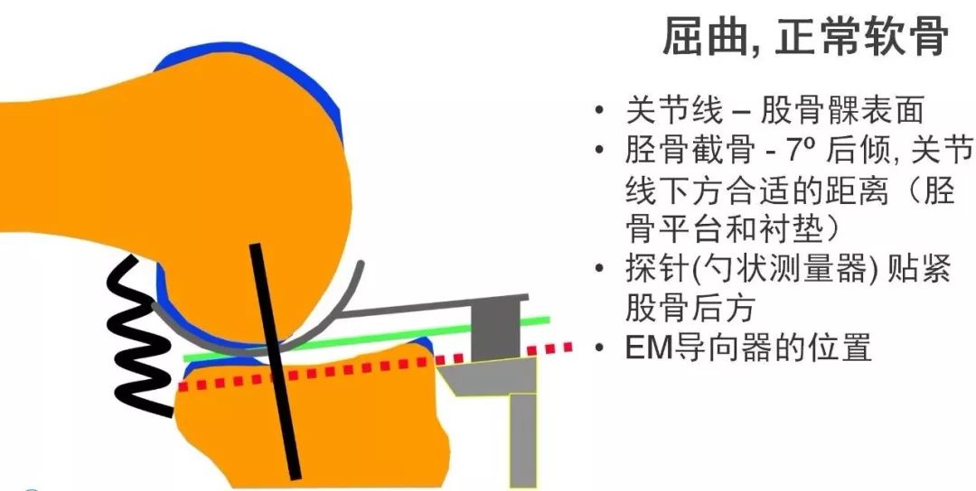 图解：单髁置换手术技巧，赶紧收藏起来！