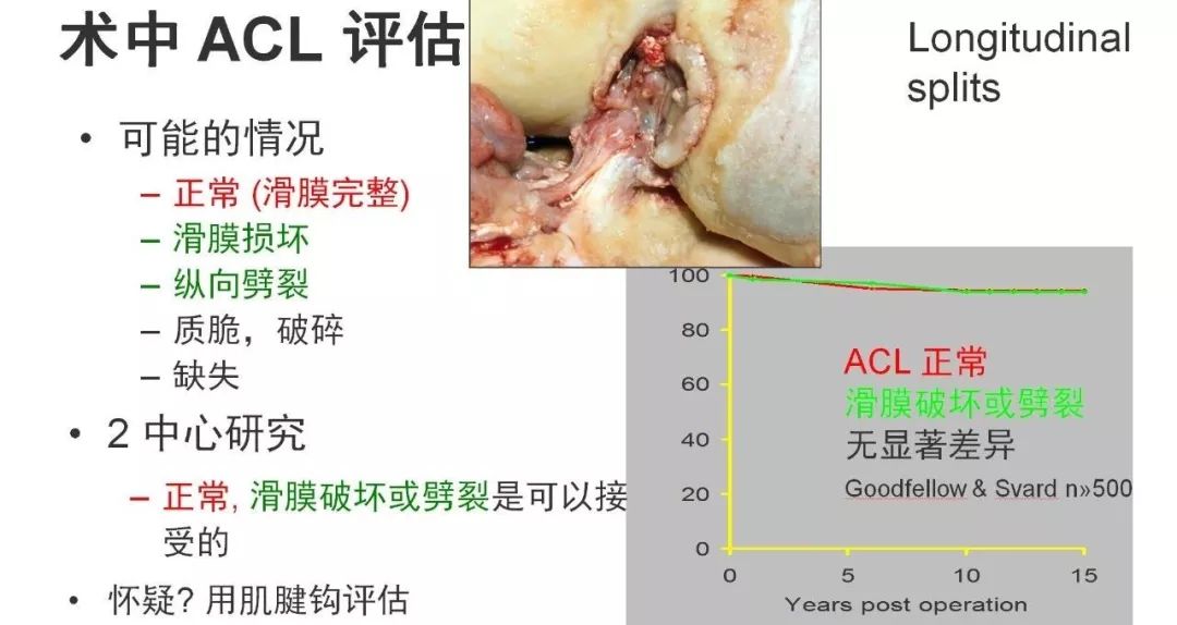 图解：单髁置换手术技巧，赶紧收藏起来！