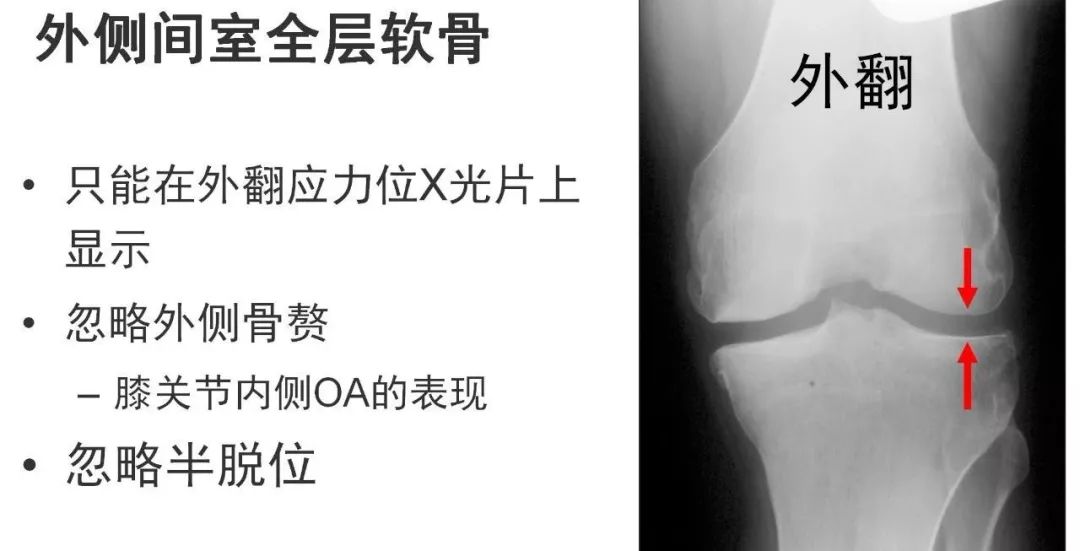 图解：单髁置换手术技巧，赶紧收藏起来！