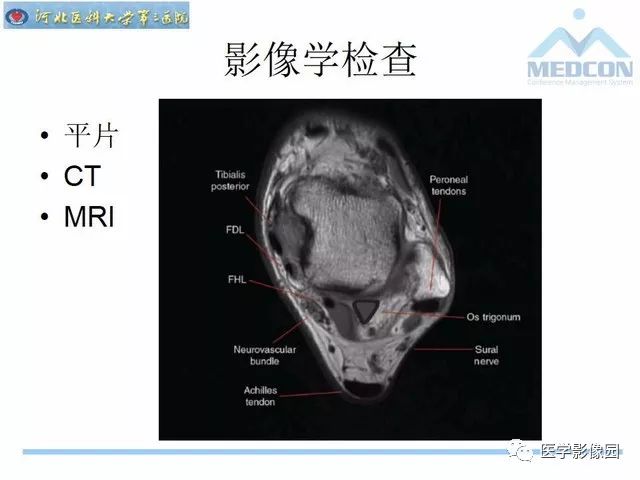 一文详解：踝关节撞击综合征影像诊断