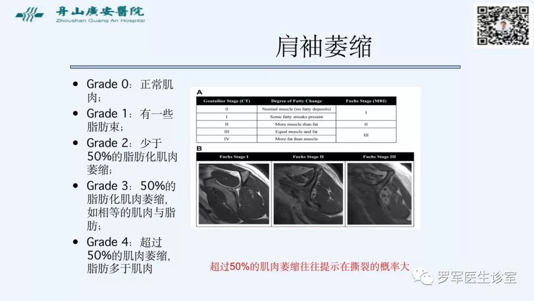 治疗肩袖撕裂，告诉你一种新的修补技术！