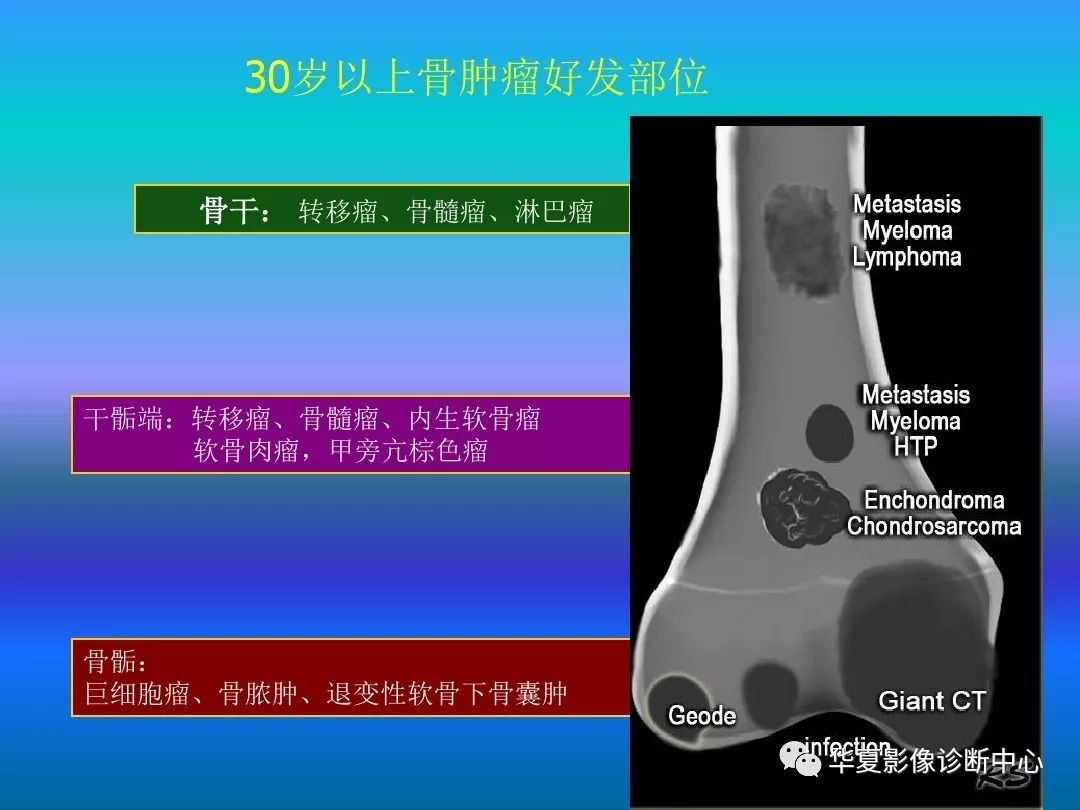 骨肿瘤/肿瘤样病变的影像诊断及策略，看这篇就够了！