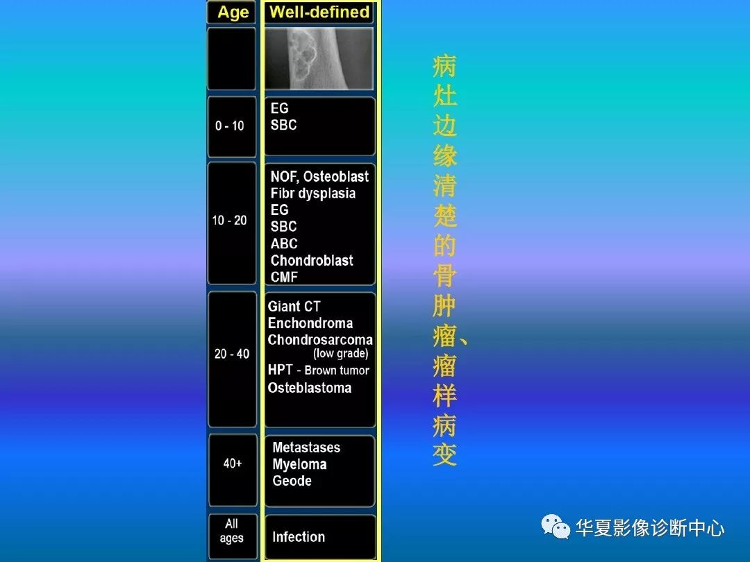 骨肿瘤/肿瘤样病变的影像诊断及策略，看这篇就够了！