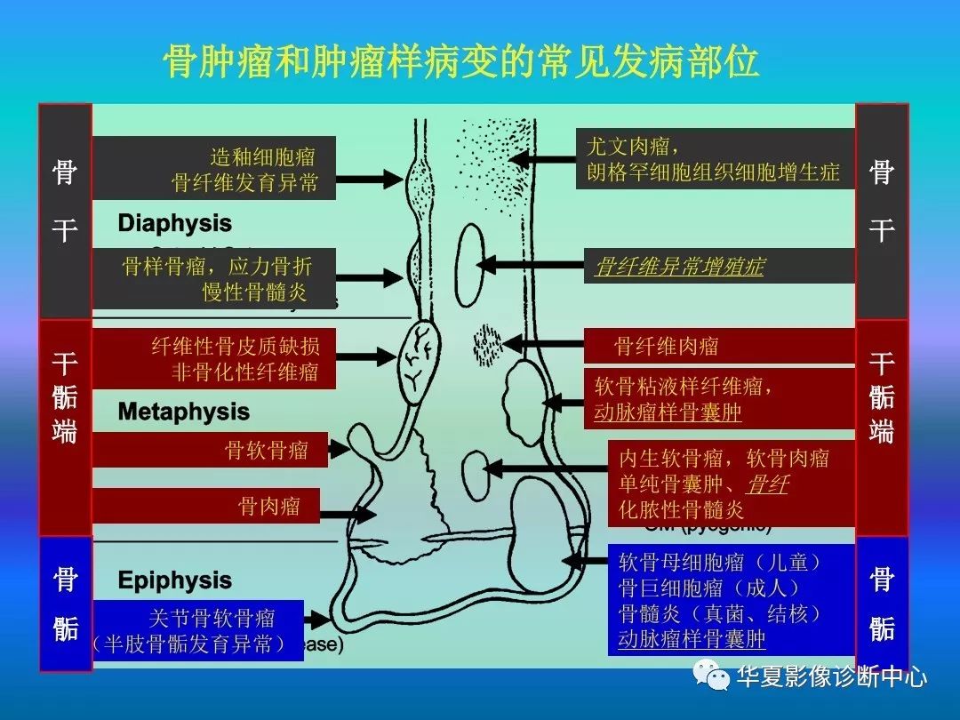 骨肿瘤/肿瘤样病变的影像诊断及策略，看这篇就够了！