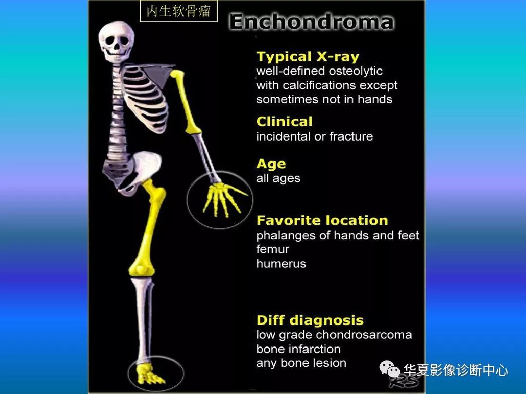 骨肿瘤/肿瘤样病变的影像诊断及策略，看这篇就够了！