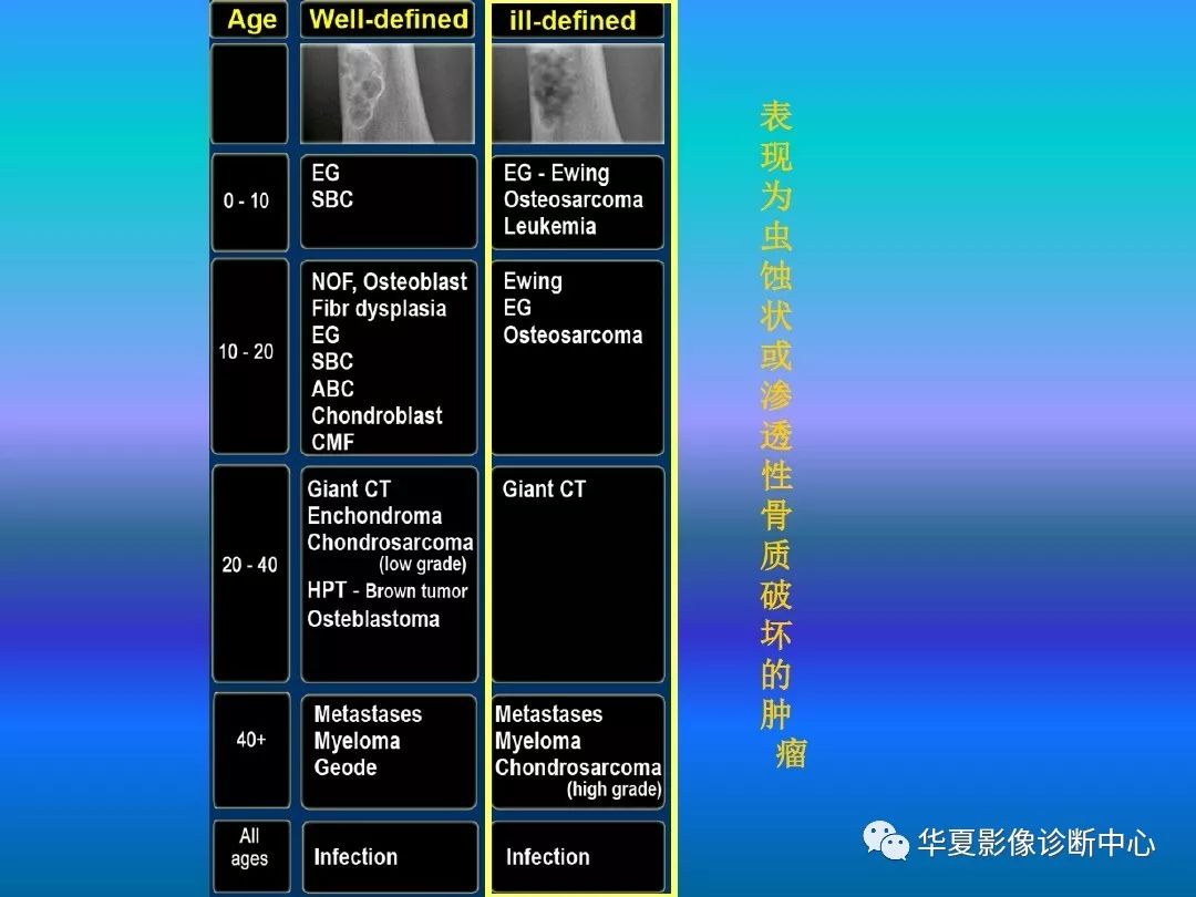 骨肿瘤/肿瘤样病变的影像诊断及策略，看这篇就够了！