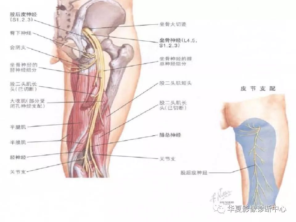 髋关节解剖学，值得收藏！