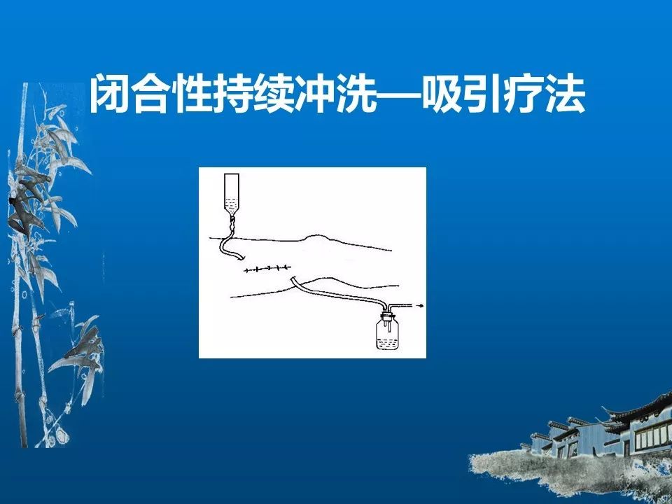 实用！慢性骨髓炎的诊断和治疗