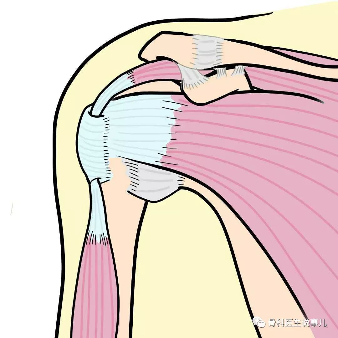 肩膀痛？小心“肩里藏刀”—带你认识“肩峰撞击综合征”