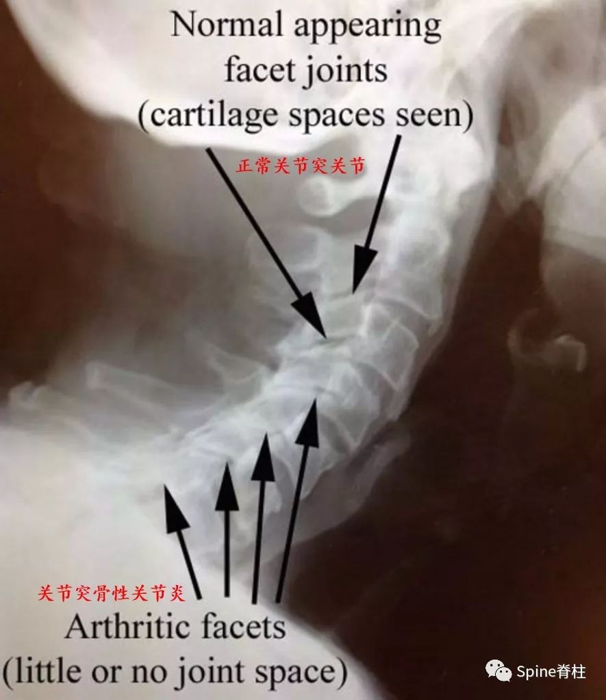 干货！颈椎