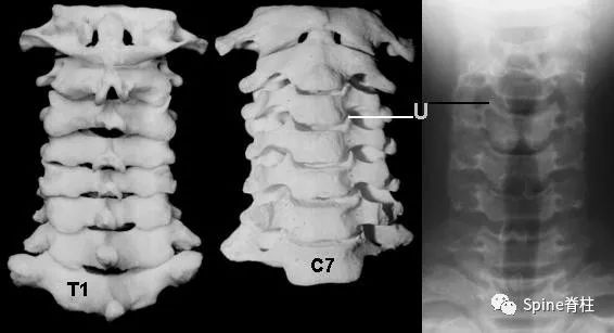 干货！颈椎