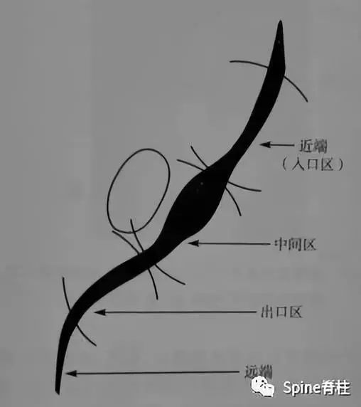 平时阅片，你注意过腰5椎体的横突吗？