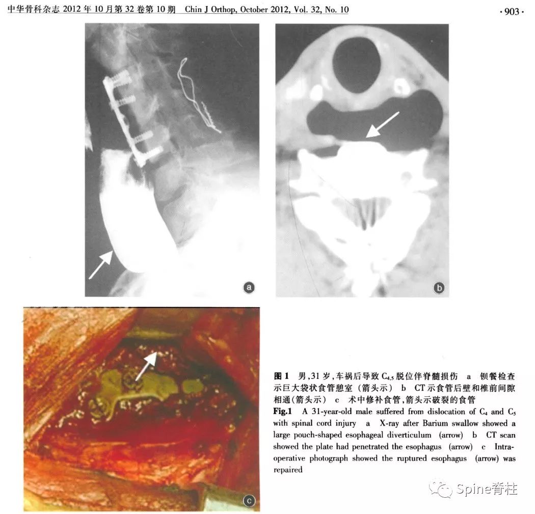 颈前路术后特殊并发症