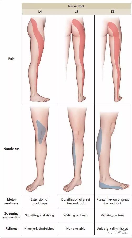 你全面了解L4-S1神经根支配区吗？