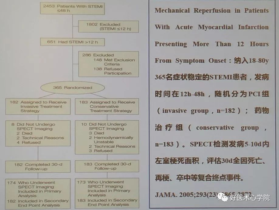 CSC2019：急性心梗错过了最佳手术时间，该何去何从？