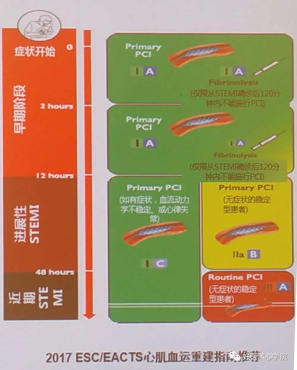 CSC2019：急性心梗错过了最佳手术时间，该何去何从？