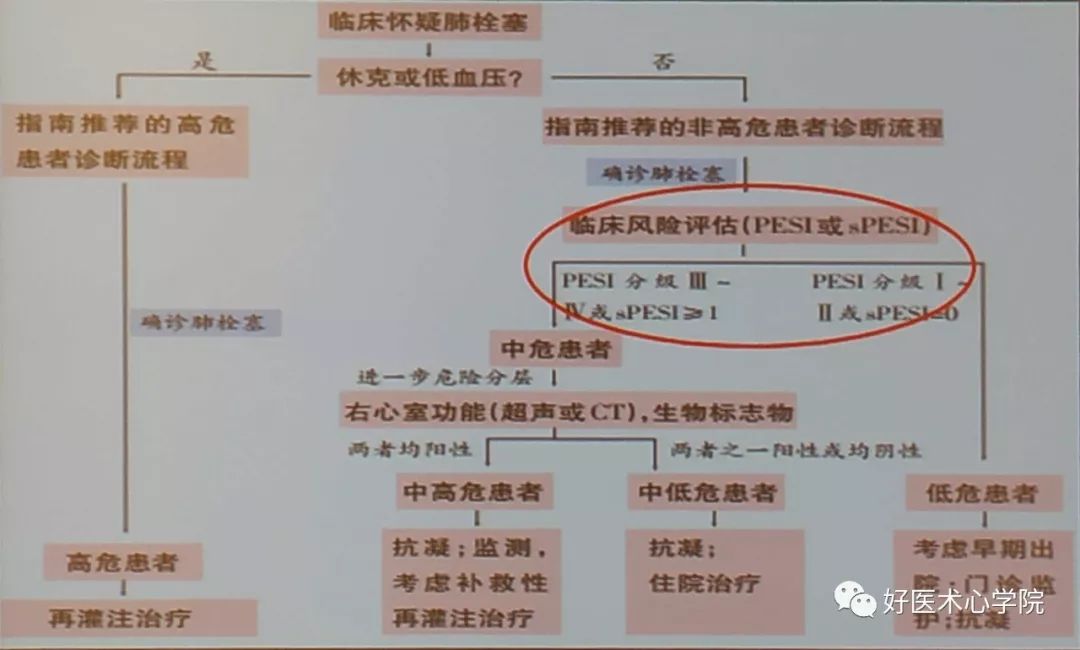 10分钟掌握遇到急性胸痛怎么办