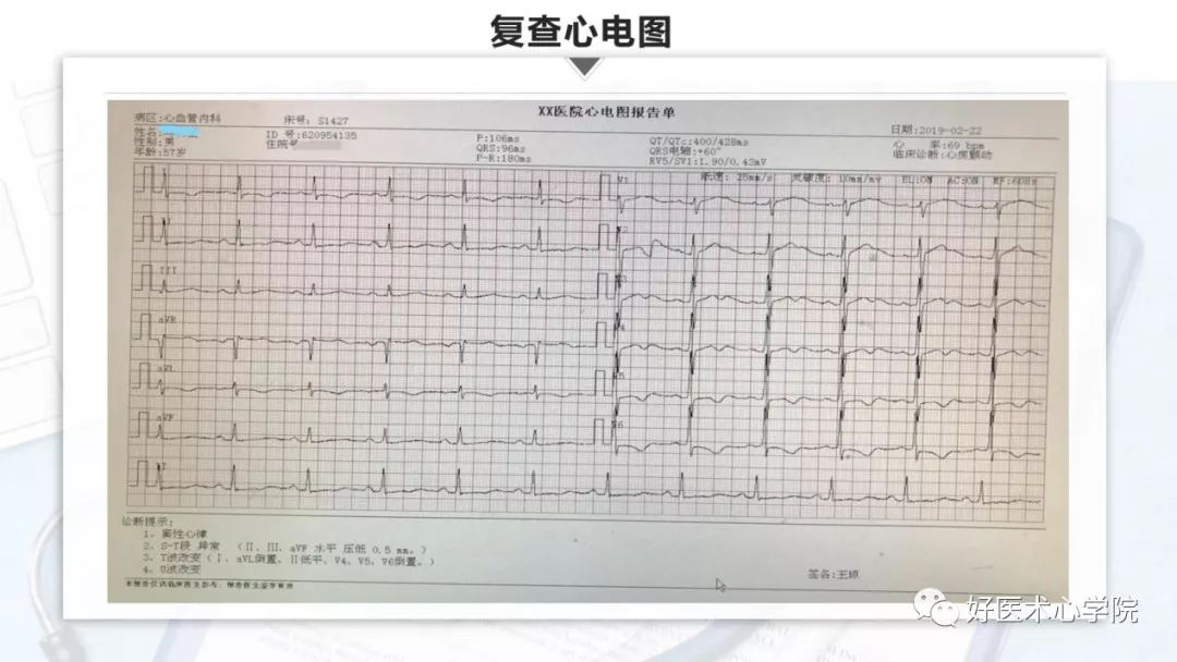 不被重视的心悸，险些酿成大祸