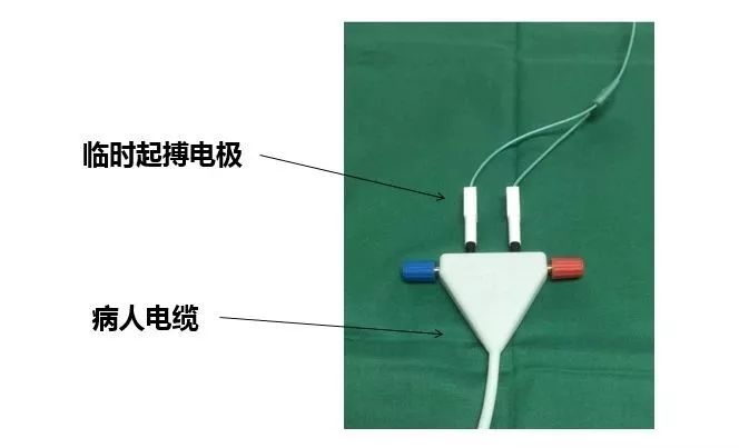 植入临时起搏器方法与技巧