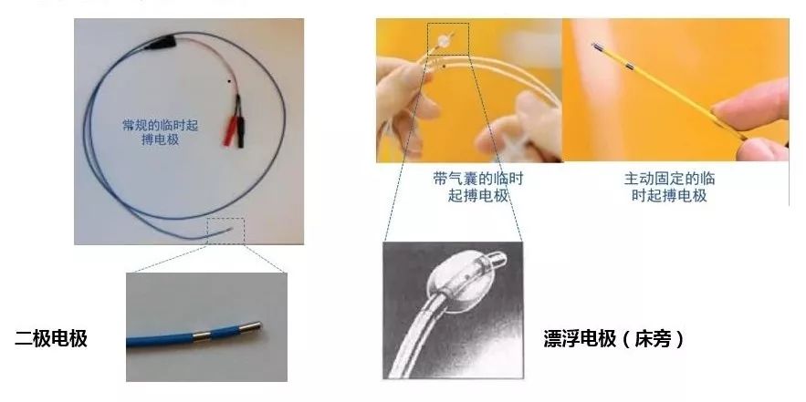 植入临时起搏器方法与技巧