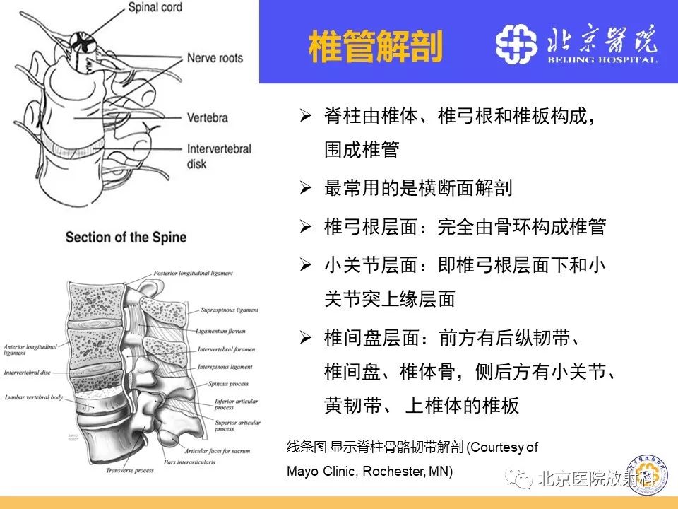 椎管狭窄的影像学检查，都在这篇文章里！