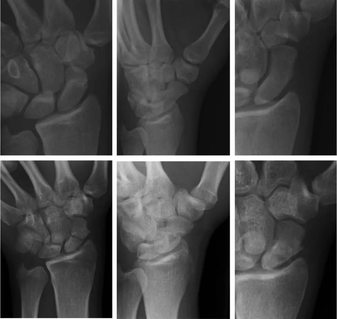 腕关节解剖及病理影像大集合，值得收藏！