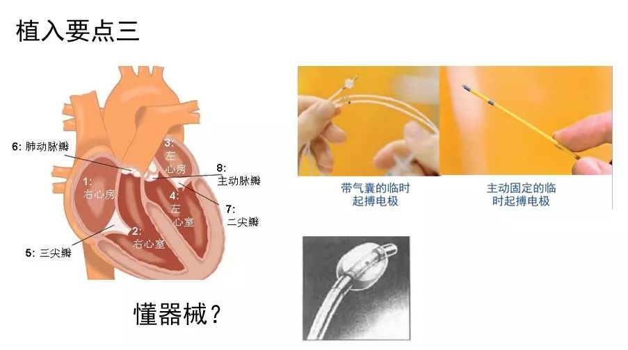 植入临时起搏器方法与技巧