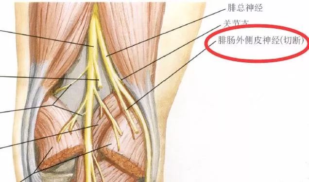 下肢神经的组成及走形汇总，赶紧收藏备用！