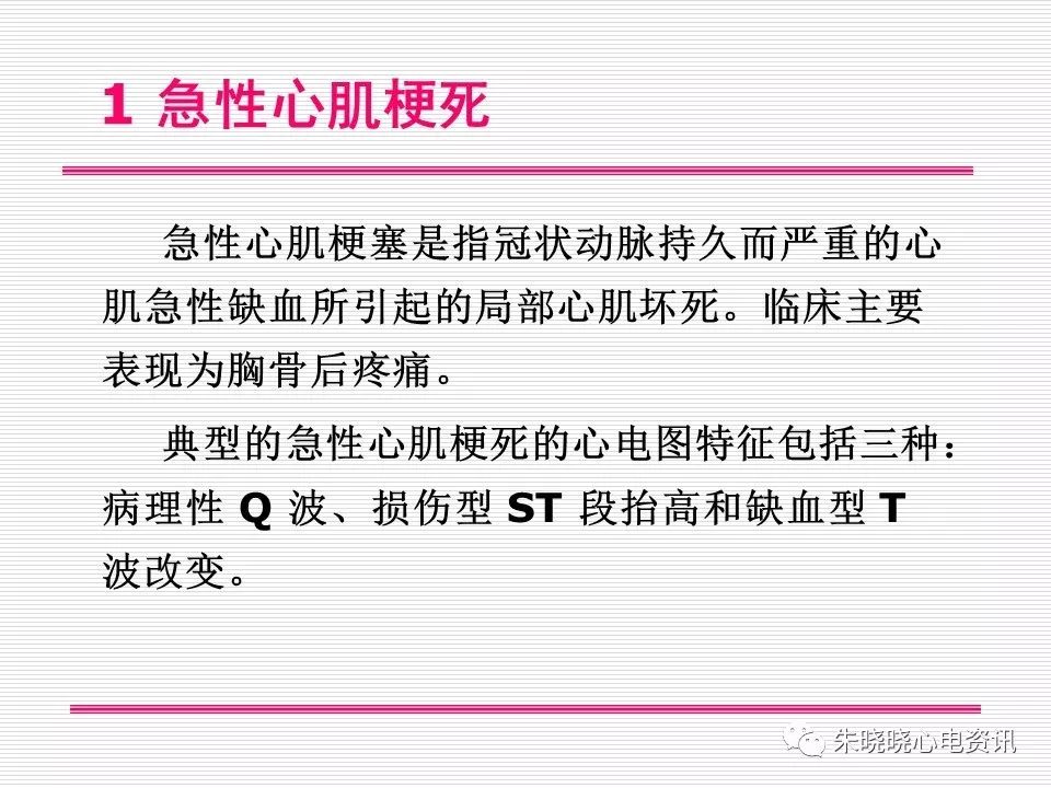 心电图危急值识别与诊断，看完我就收藏了！