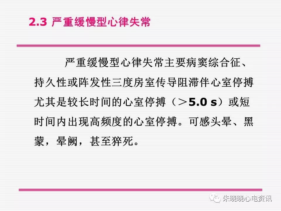 心电图危急值识别与诊断，看完我就收藏了！