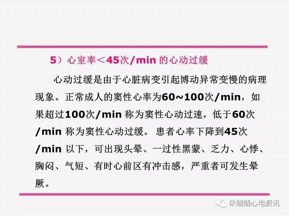 心电图危急值识别与诊断，看完我就收藏了！