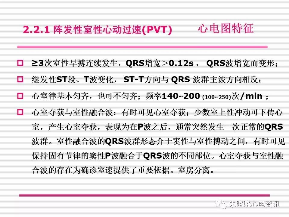 心电图危急值识别与诊断，看完我就收藏了！