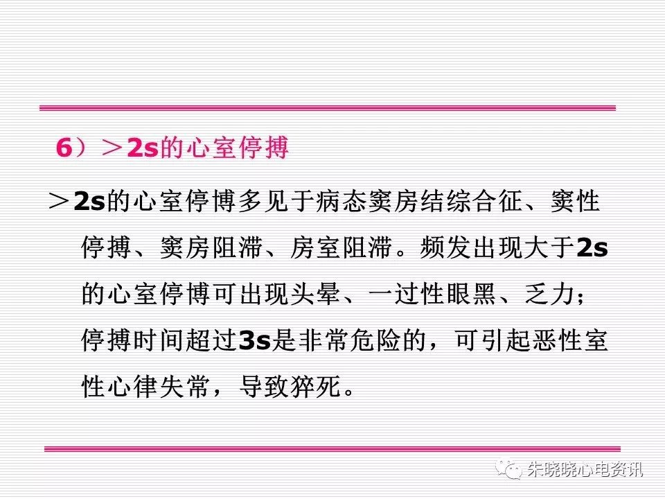 心电图危急值识别与诊断，看完我就收藏了！